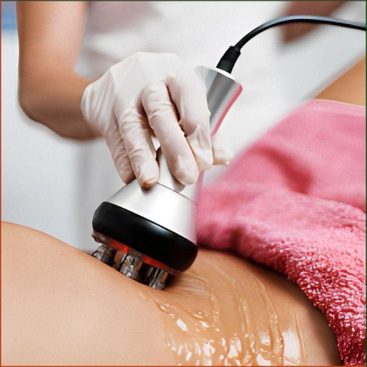 RF Skin Tightening